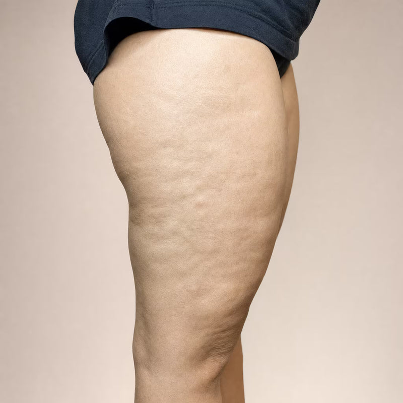 Close-up side view of a person's upper leg and hip wearing dark navy shorts against a plain beige studio background.