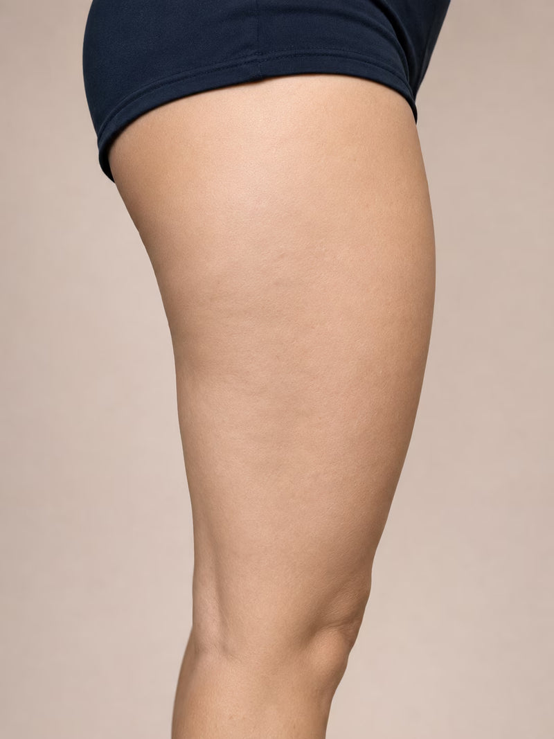 Close-up side view of a person's thigh wearing dark navy athletic shorts against a plain beige studio background.